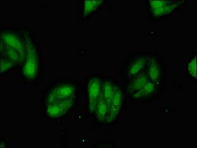 MGST2 antibody