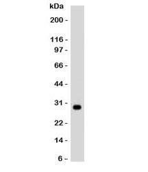 HLA-DRB1 Antibody (MHC II)