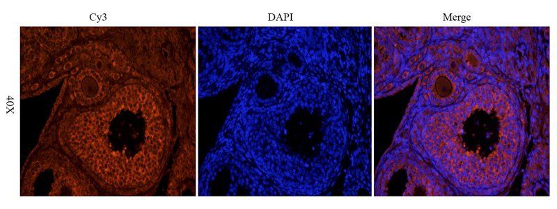 HLA-A antibody