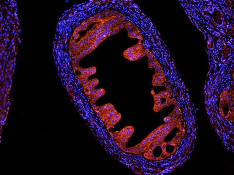 HLA-A antibody