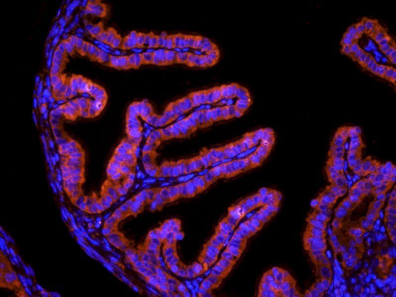 HLA-A antibody