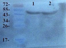 HLA-A antibody