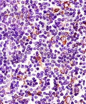 MHC Class II Rabbit Polyclonal Antibody