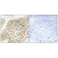 MIA Antibody
