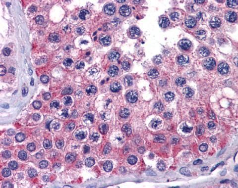 MIA3 antibody [N1], N-term