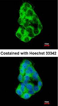 MIA3 antibody