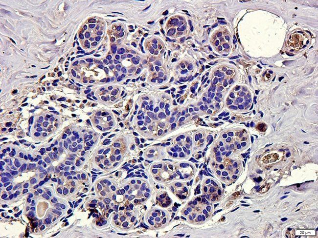 MIB1 antibody