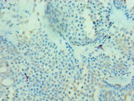MICA Antibody