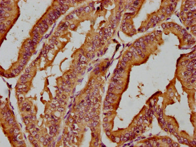 MICAL1 Antibody
