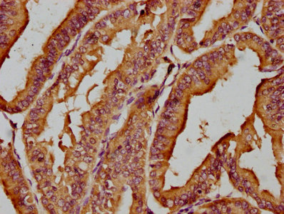 MICAL1 antibody