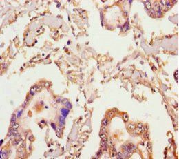 MICAL2 Antibody