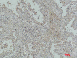 MICU1 antibody