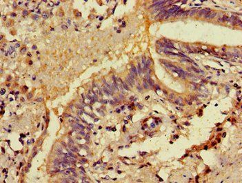 MICU2 Antibody