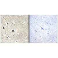 MID1 Antibody