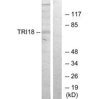 MID1 antibody