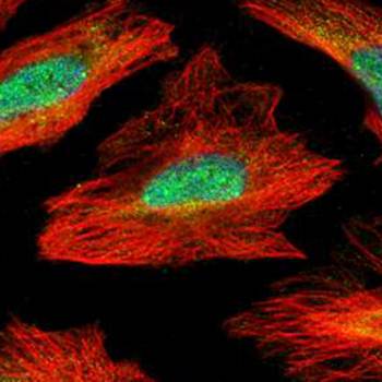 MID1 interacting G12-like protein antibody