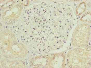 MID2 Antibody