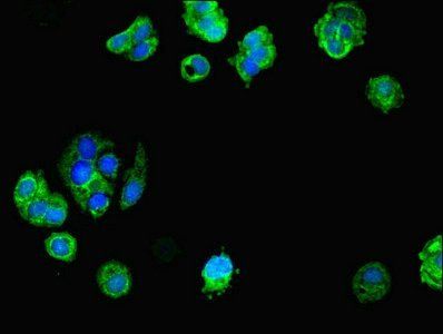 MID2 antibody