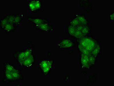 Midkine antibody