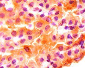 MDK Antibody