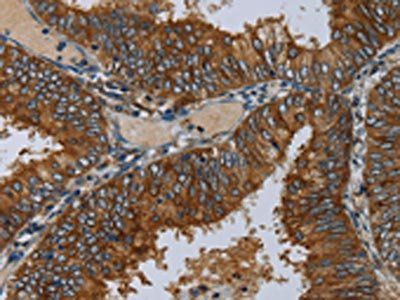 MIER2 Antibody