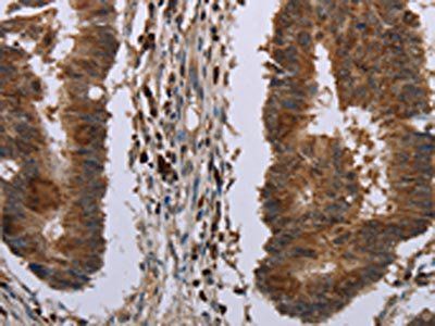 MIG7 Antibody