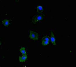 RIOX2 Antibody