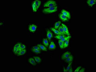 MIP Antibody