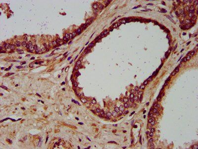 MIP Antibody