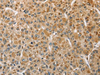 MIP Antibody