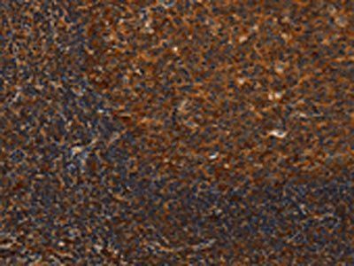 MIP Antibody