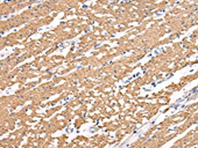 MIP Antibody