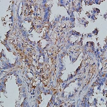 CCL19 Rabbit Polyclonal Antibody