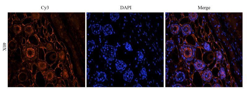 MIP3 beta antibody