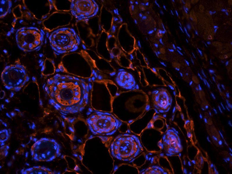 MIP3 beta antibody