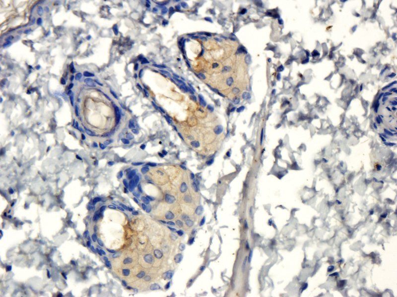 MIP3 beta antibody