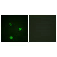 MITF (Ab-180/73) Antibody