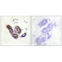 MITF (Ab-180/73) Antibody
