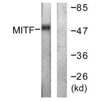 MITF (Ab-180/73) Antibody