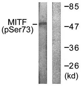 MITF (Phospho-Ser180/73) Antibody