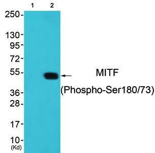 MITF (phospho-Ser180/73) antibody
