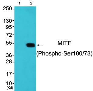 MITF (Phospho-Ser180/73) Antibody