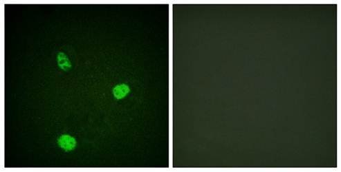 MITF (Ab-180/73) Antibody