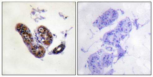 MITF (Ab-180/73) Antibody