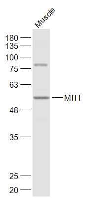 MITF antibody