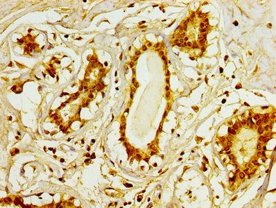 Mitochondrial brown fat uncoupling protein 1 antibody