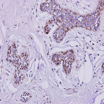 mitochondrial carrier protein MGC4399 Rabbit Polyclonal Antibody