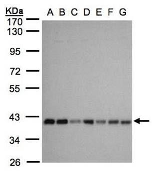 mitochondrial carrier protein MGC4399 Rabbit Polyclonal Antibody
