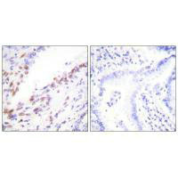 MKI67 Antibody