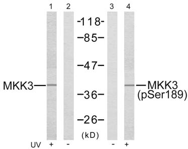 MKK3 (Phospho-Ser189) Antibody